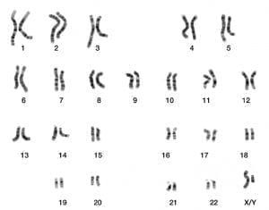 Interesting Facts About Chromosomes | For Kids | How Many