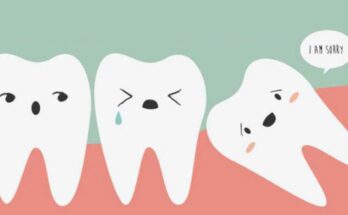 Truth About Third Molars
