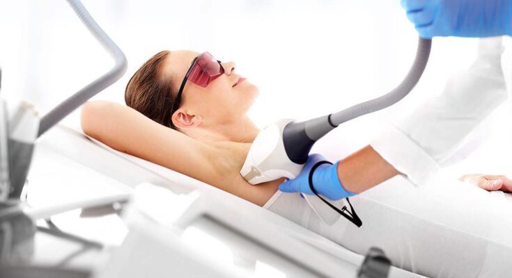 IPL Hair Removal Procedure