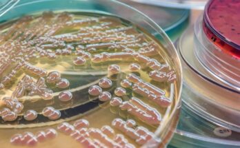 An up close petri dish with red agar gel in the contents. The agar gel is forming red bubbles for cell culture testing.